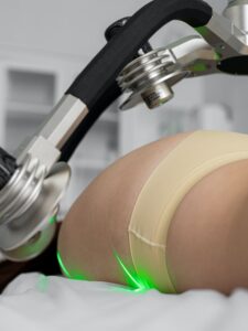 fat removal